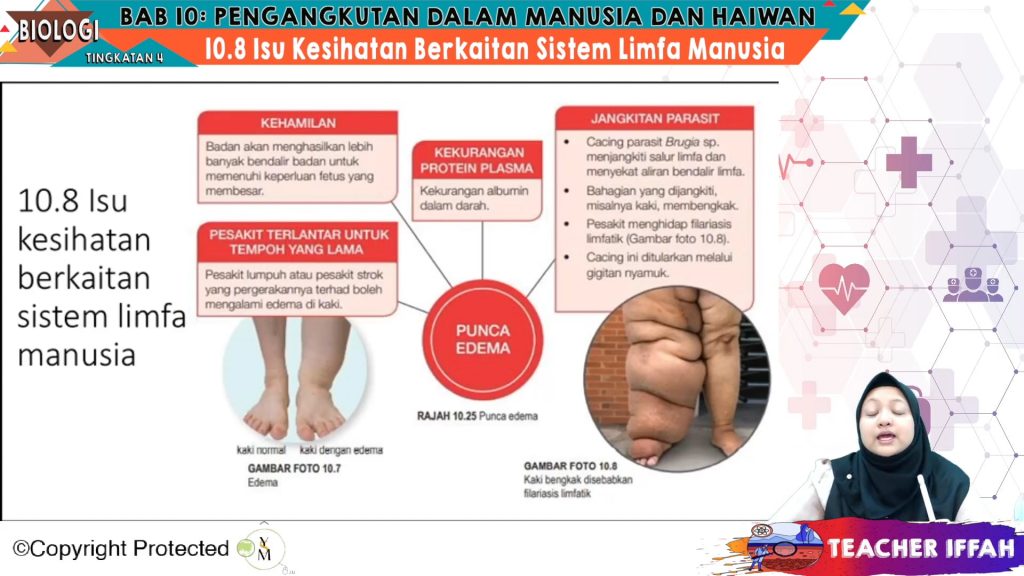 F4 Bio 10 10 Isu Kesihatan Berkaitan Sistem Limfa Manusia – My E Tuition