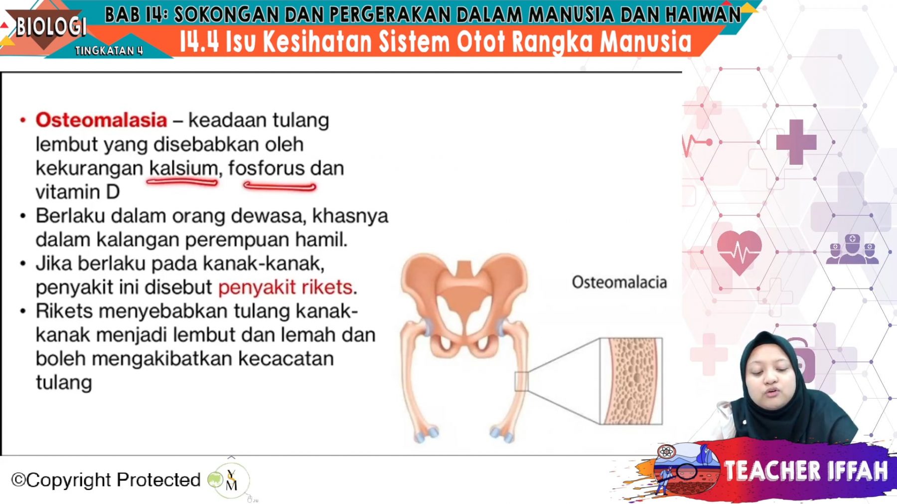 F4 Bio 14 05 Isu Kesihatan Sistem Otot Rangka Manusia – My E Tuition